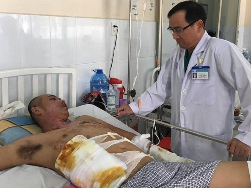 thiết bị ecspd thông minh- 1