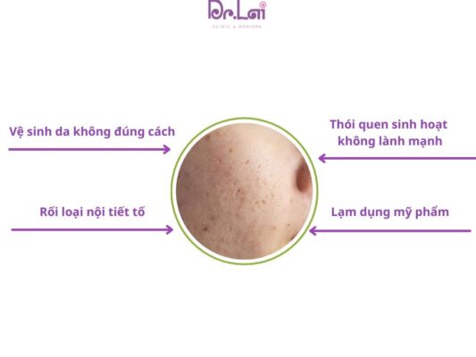 Dùng mỹ phẩm gây bí da
